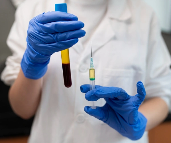 What is PRP Treatment