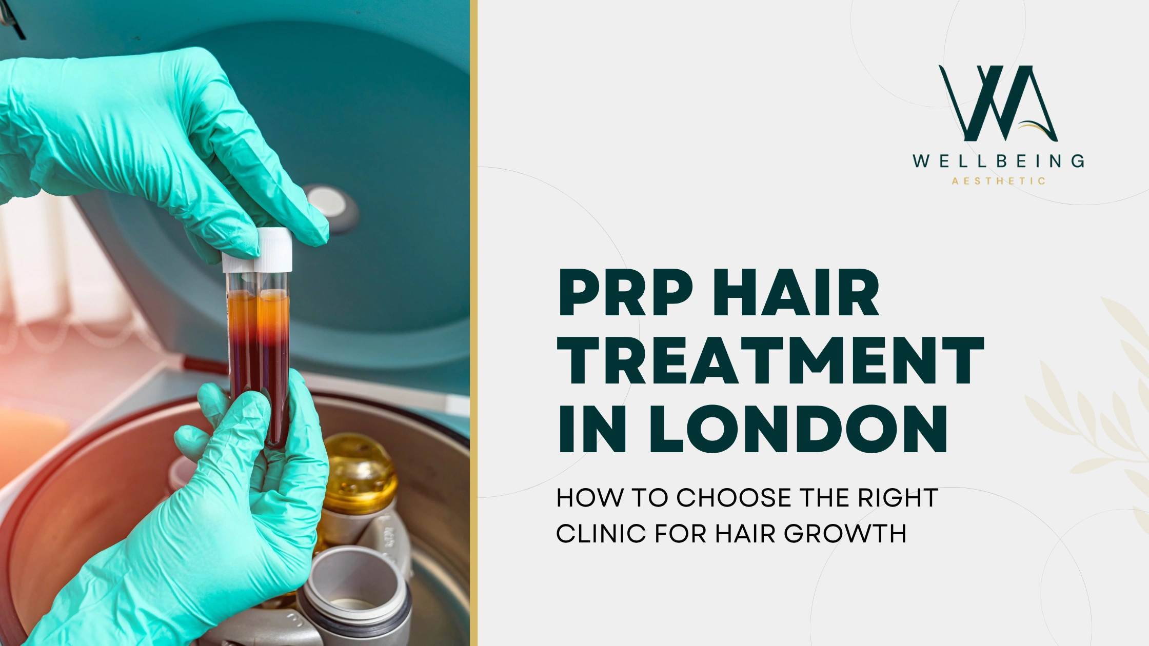 PRP Hair Treatment in London How to Choose the Right Clinic for Hair Growth