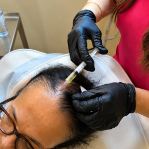 PRP Hair Treatment in London